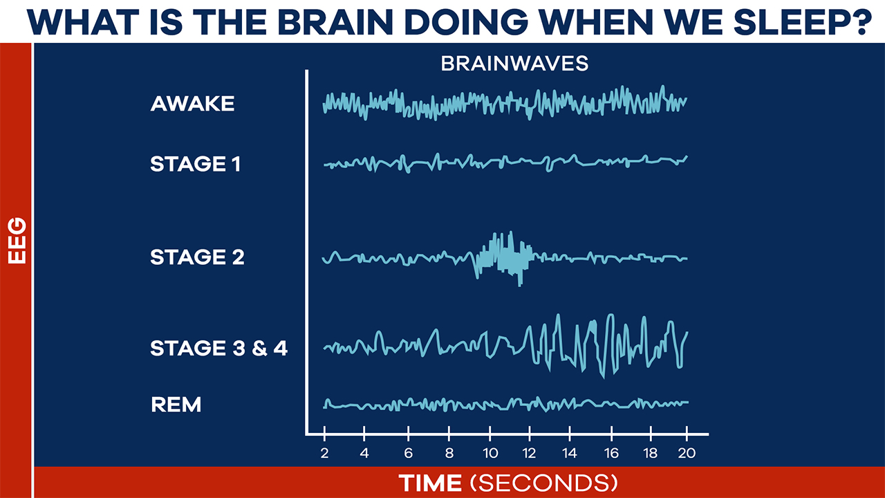 in rem sleep brain